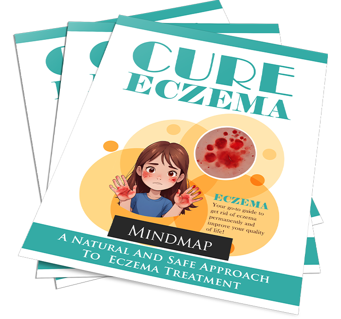 Cure Eczema - Image 3