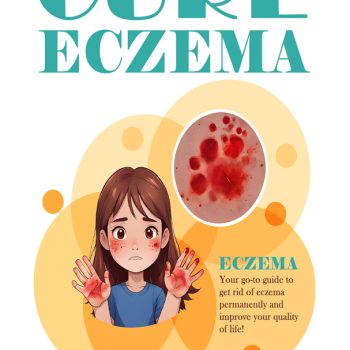 Cure Eczema